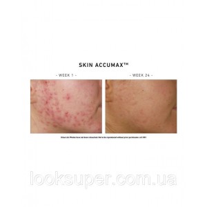 Программа питания для проблемной  кожи Skin Accumax  Advanced Nutrition Programme (120 Cap)