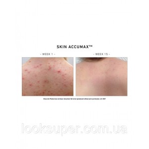 Программа питания для проблемной кожи Skin Accumax Advanced Nutrition Programme Skin Accumax 60 Capsules