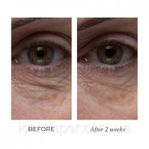 Восстанавливающий крем для глаз ELEMIS Peptide⁴ Eye Recovery Cream 15ml